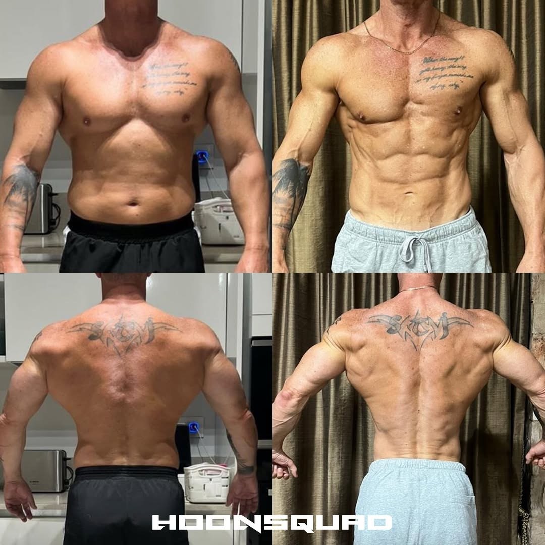 JP&rsquo;s published HOONSQUAD plate: a male client front and back, before beside after, 4 of 4